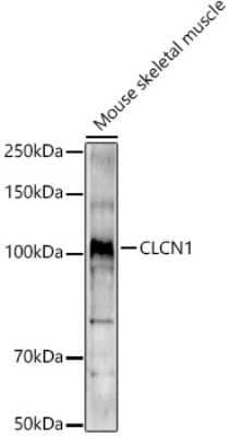 Western Blot: CLCN1 AntibodyBSA Free [NBP2-92461]